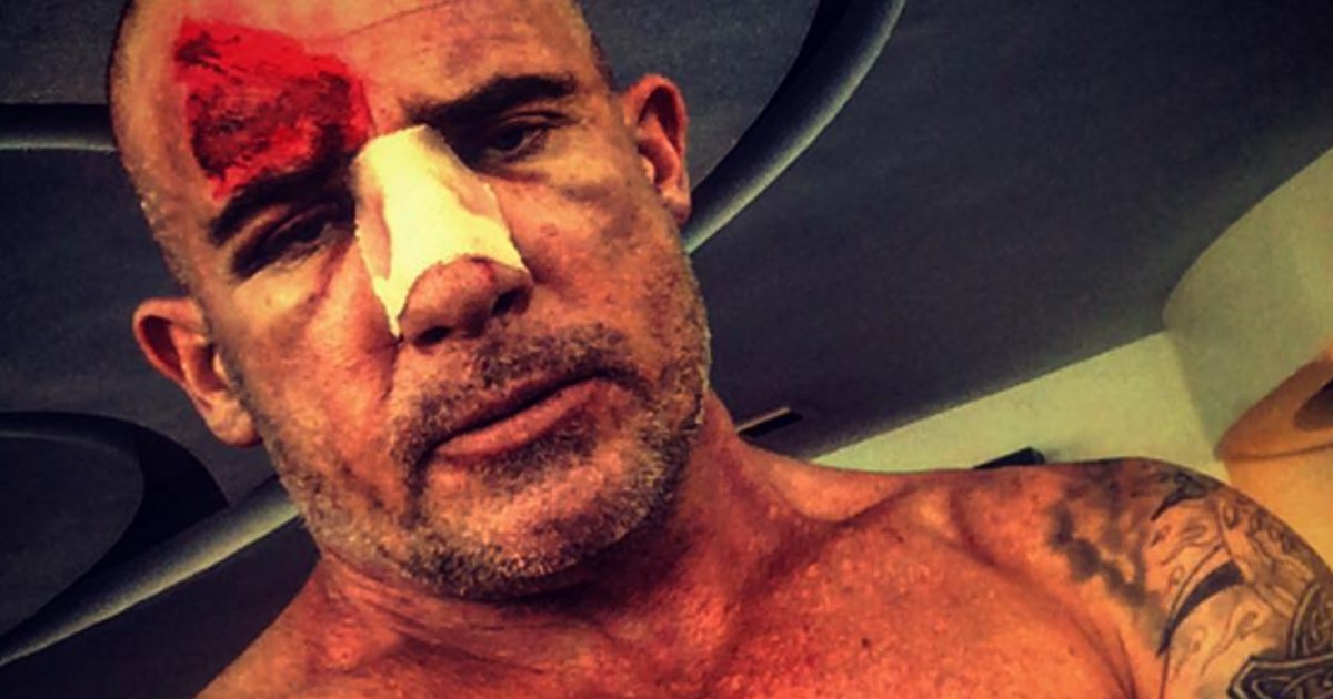 dominic purcell injured