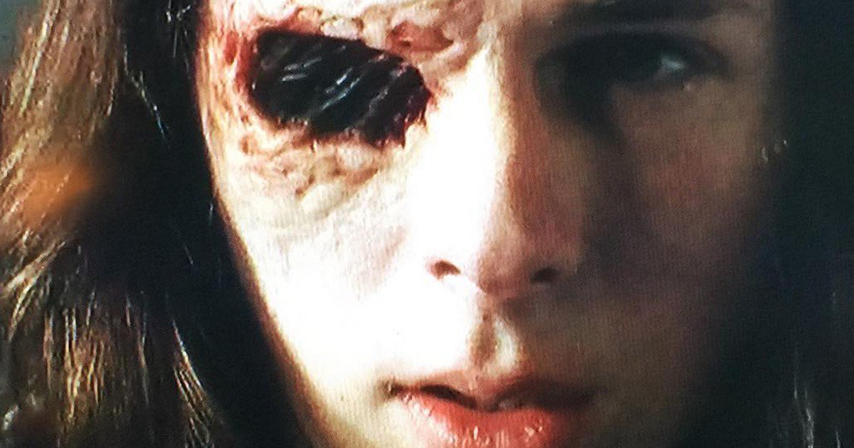 walking dead chandler riggs carls eye The Walking Dead: Chandler Riggs Shares Pics Of Carl's Eye